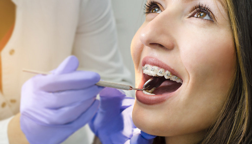 Ortodonzia a Rimini, apparecchi per denti Studio Dentistico Bianchini