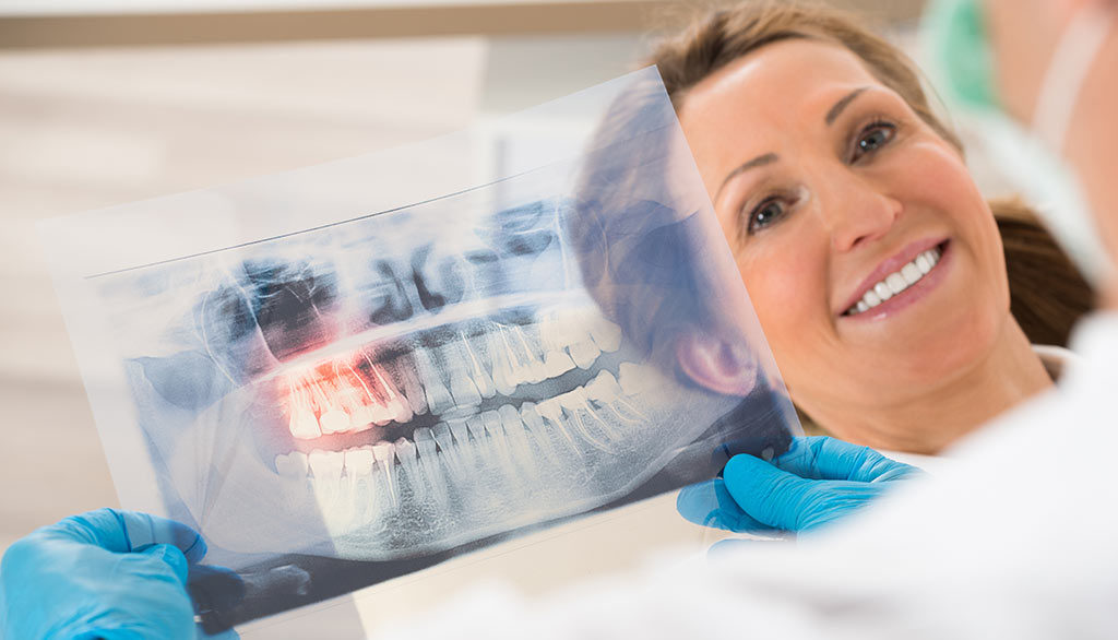 Radiografia denti a Rimini, esami diagnostici Rx endorali e Opt panoramiche